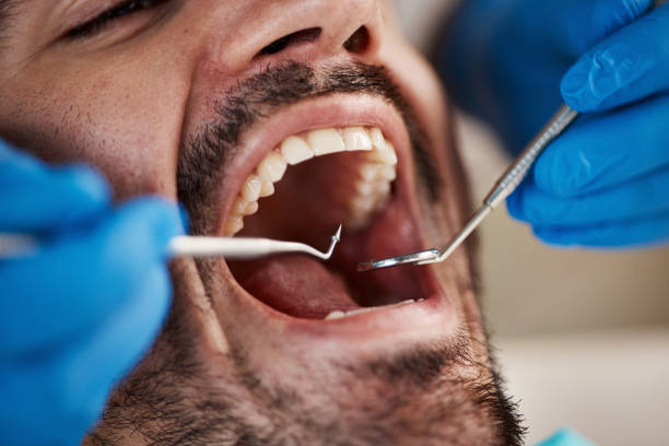 Best Emergency Broken Tooth Repair in Kapn, LA